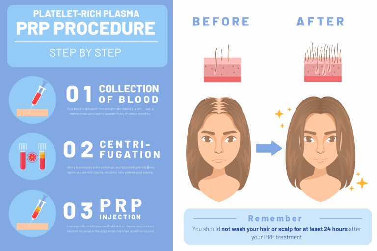 PRP Treatment - US:KIN Aesthetic Clinic